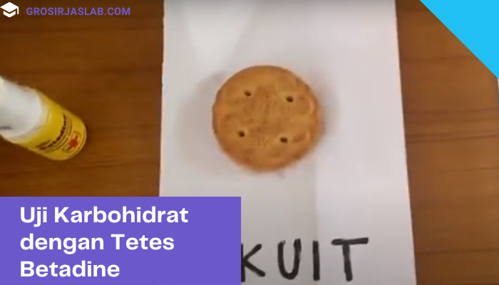 praktikum uji karbohidrat dengan betadine